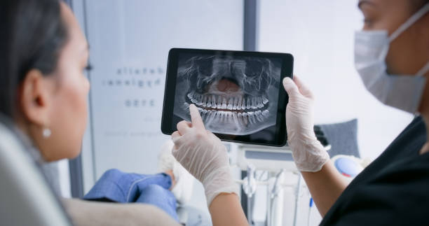 Licensed Teeth Whitening service in Tioga, ND - Smile Center Dentistry